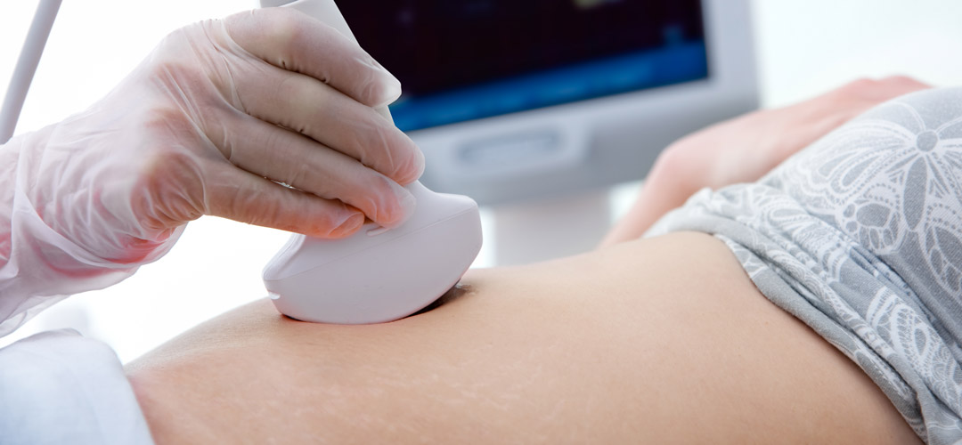 woman receiving a sonogram